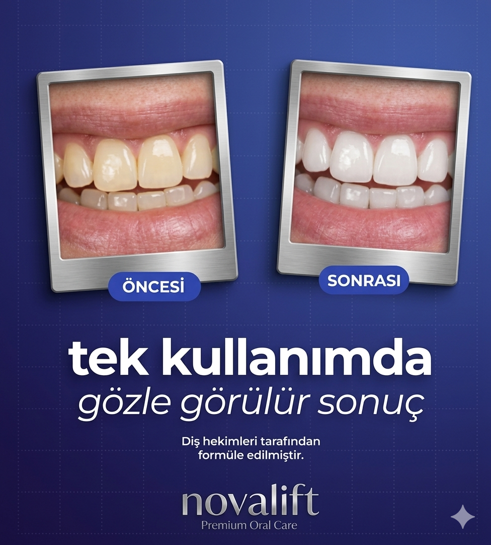 Profesyonel Diş Beyazlatma Bandı (Mor Etkili) – Evde Kolay Kullanım
